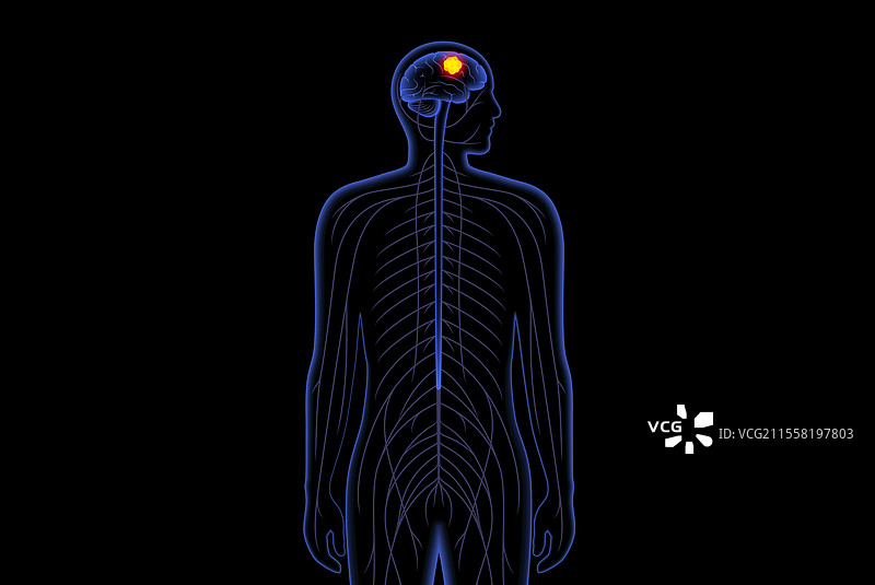 脑癌海报图片素材