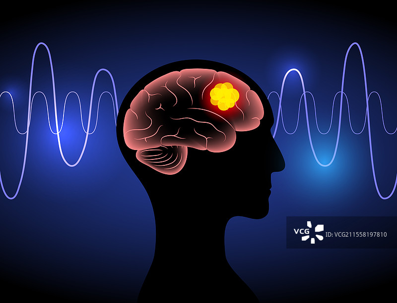 脑癌海报图片素材