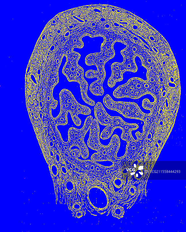 输卵管插图图片素材