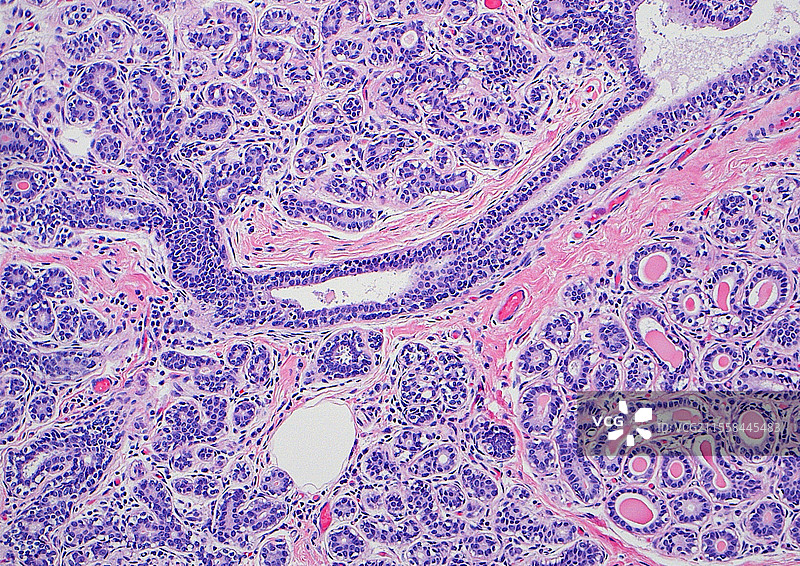 乳腺小叶和导管，光学显微镜图像图片素材