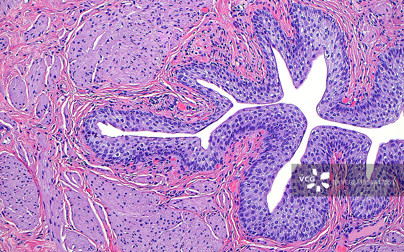 输尿管，光学显微镜图像图片素材