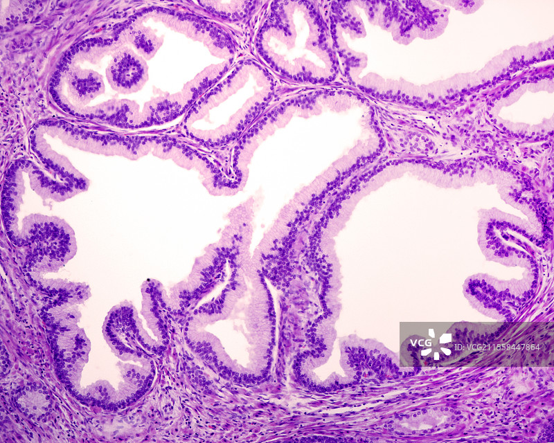 前列腺，光学显微镜图像图片素材