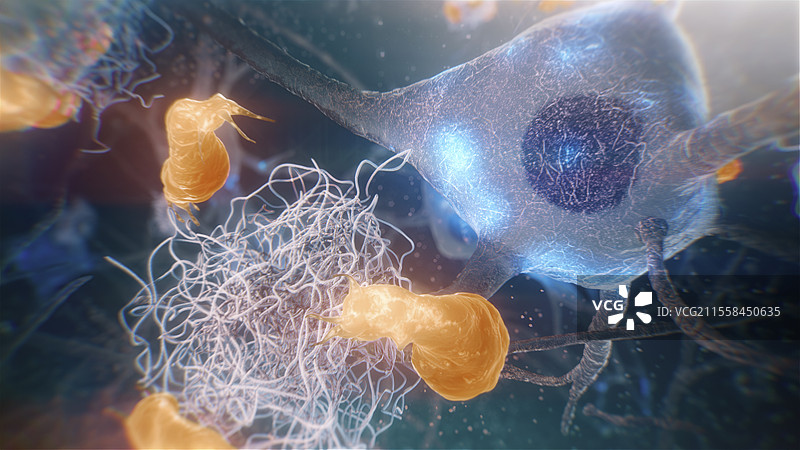 阿尔茨海默病中的小胶质细胞插图图片素材