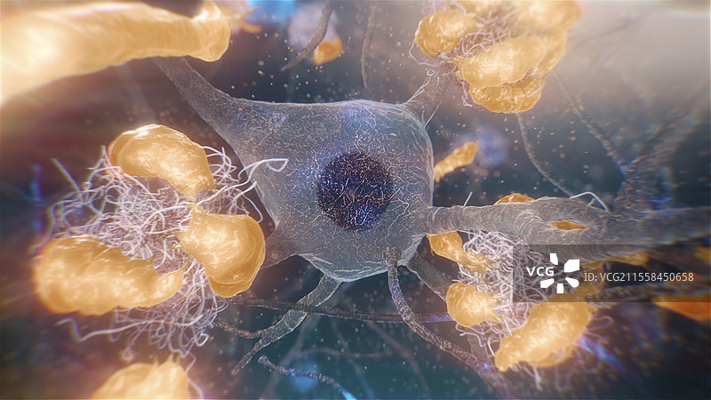 阿尔茨海默病中的小胶质细胞插图图片素材