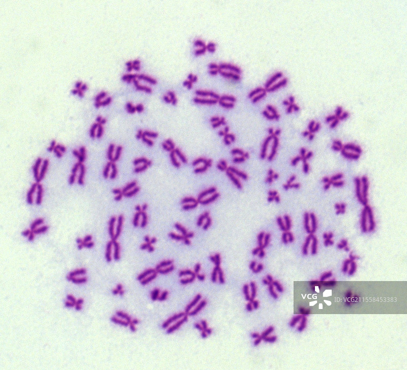 人类癌细胞染色体，光学显微镜图像图片素材