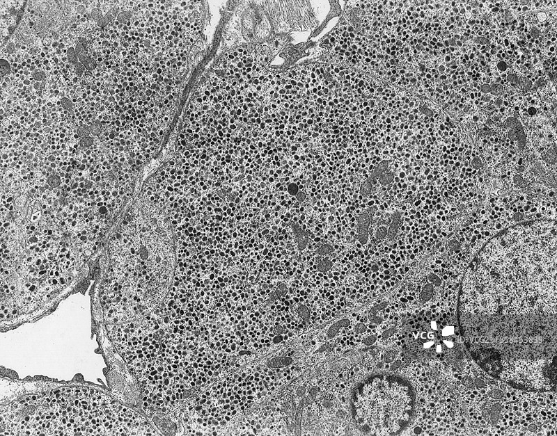 肾上腺髓质，透射电子显微镜图片素材