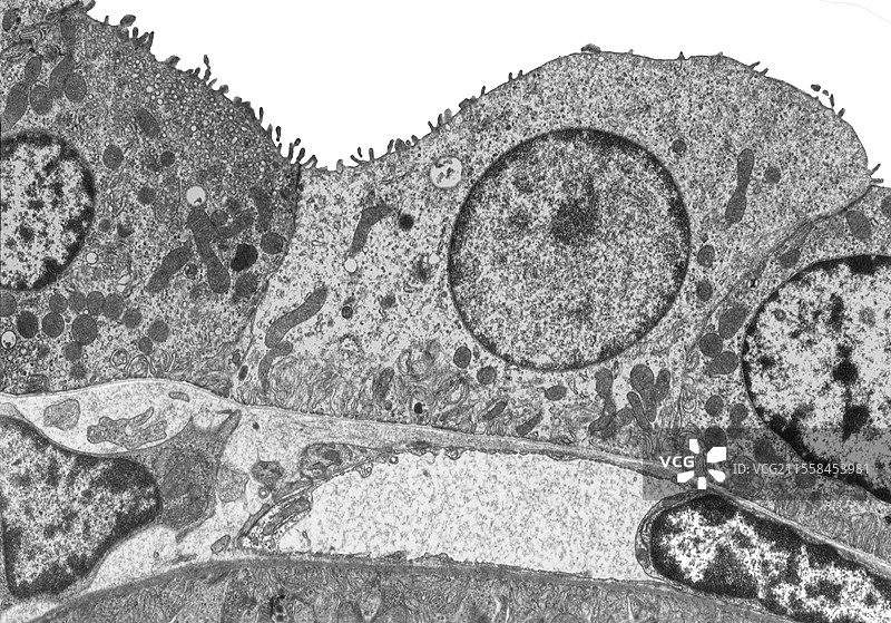 肾小管收集管上皮，透射电子显微镜图片素材