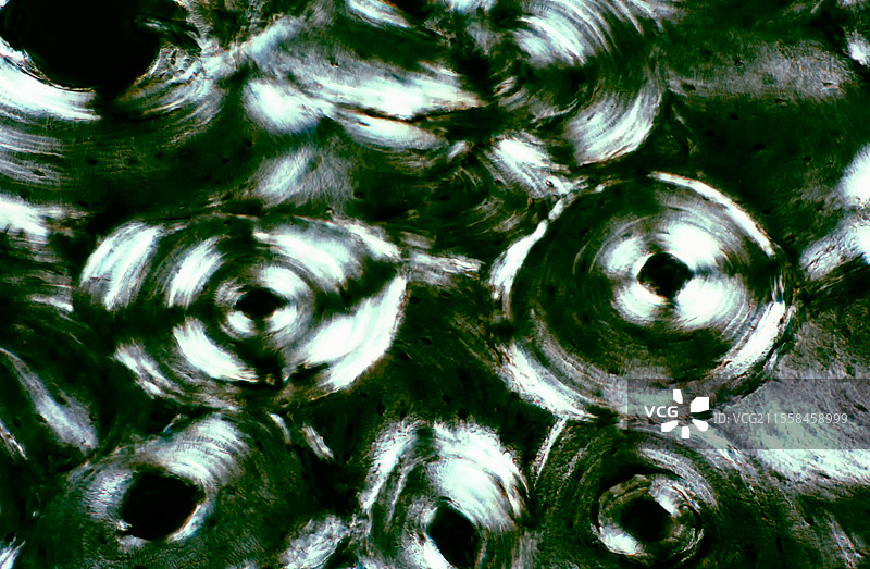 皮质骨，偏振光显微镜图像图片素材