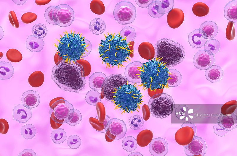 非霍奇金淋巴瘤的CAR-T细胞疗法插图图片素材