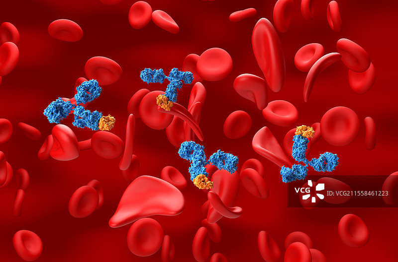 镰状细胞贫血的单克隆抗体治疗插图图片素材