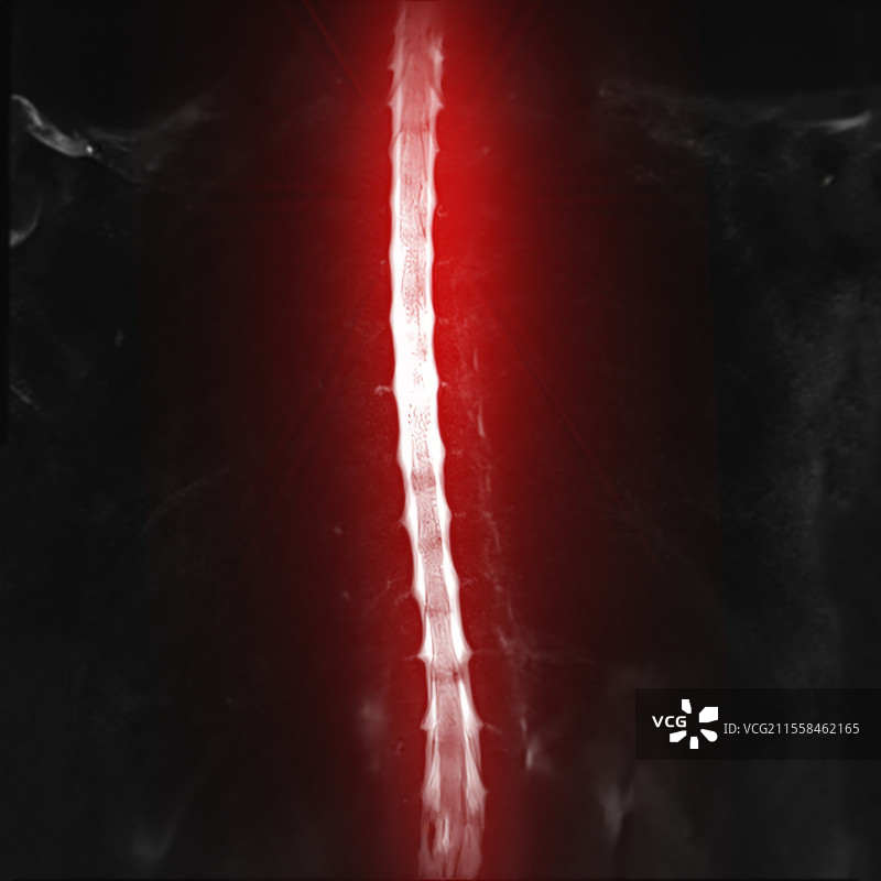 健康的胸椎，脊髓造影图片素材