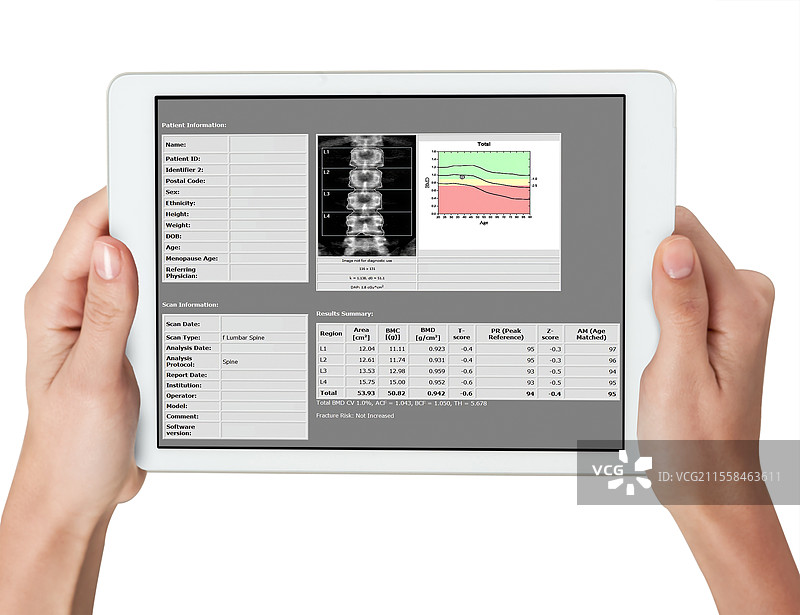 脊柱骨密度扫描的概念图图片素材