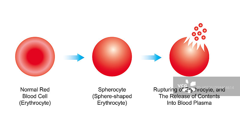 溶血，插图图片素材