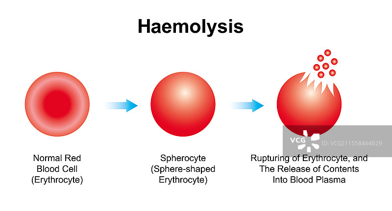 溶血，插图图片素材