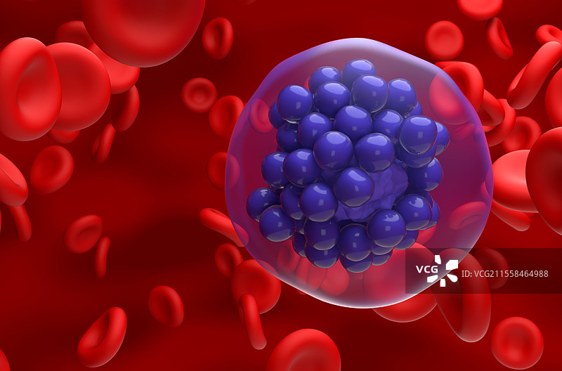 弥漫性大B细胞淋巴瘤插图图片素材