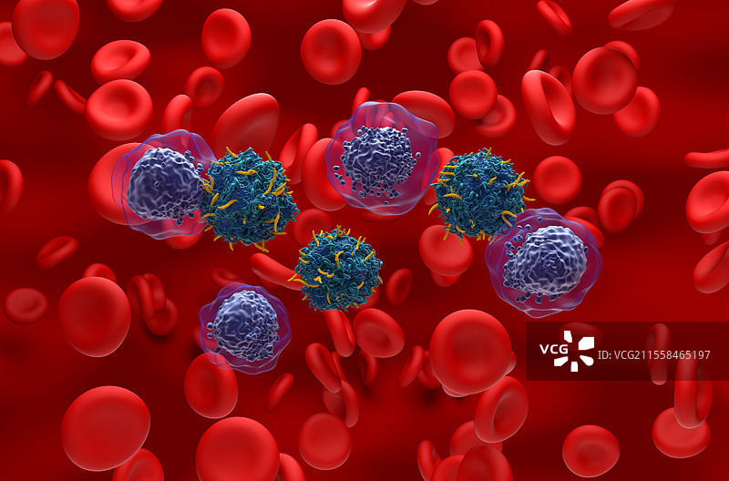 急性髓性白血病的CAR-T细胞疗法插图图片素材