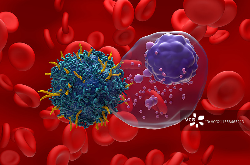 多发性骨髓瘤的CAR-T细胞疗法插图图片素材