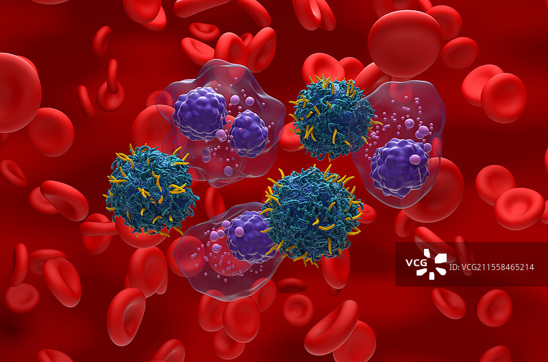 多发性骨髓瘤的CAR-T细胞疗法插图图片素材