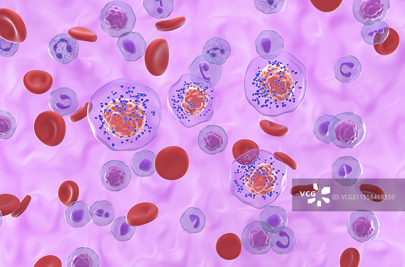 三阴性乳腺癌细胞插图图片素材