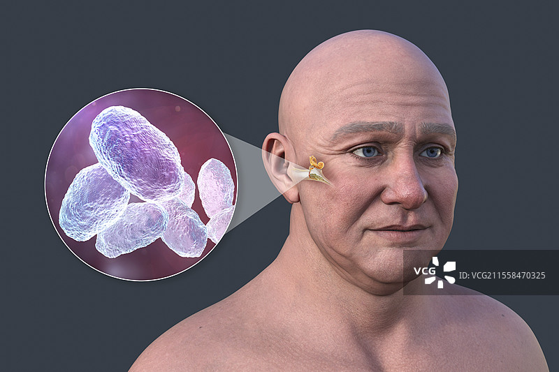 男性中耳炎插图图片素材