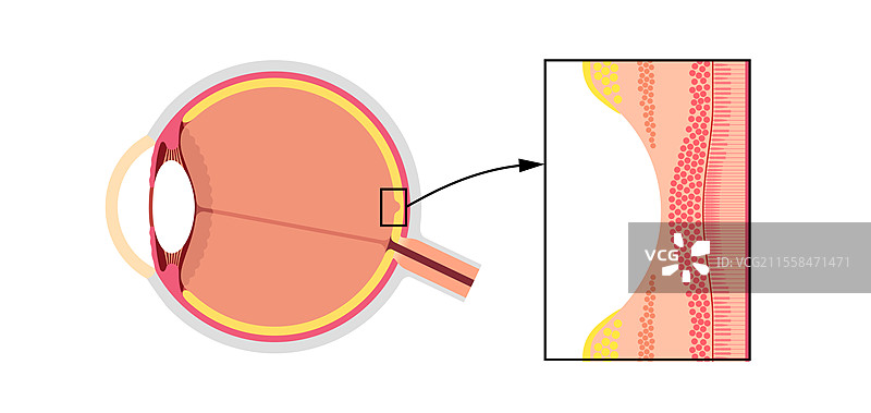 黄斑中心凹和小中心凹插图图片素材