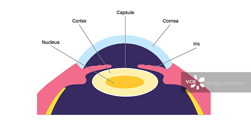 人眼晶状体，插图图片素材
