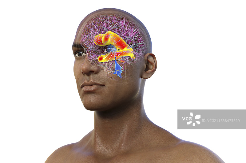 脑部侧脑室增大的插图图片素材