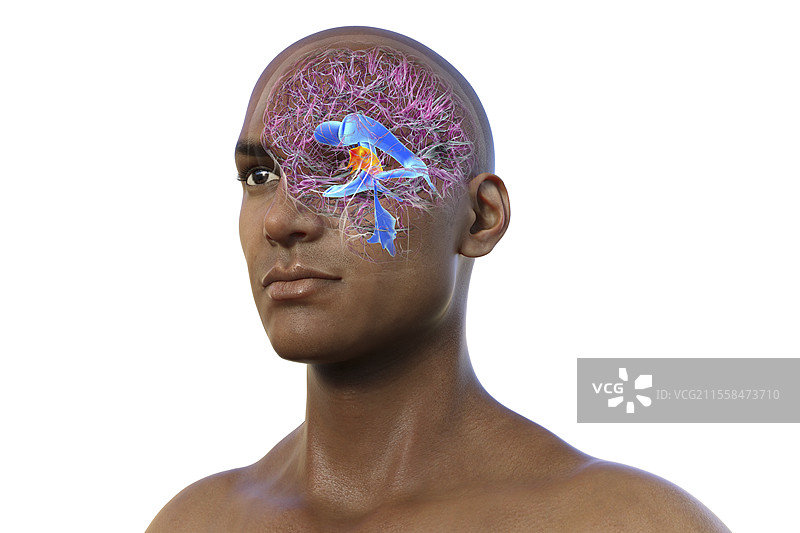 第三脑室，插图图片素材