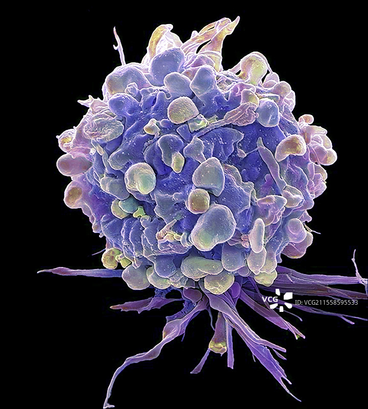 化疗诱导的细胞死亡，扫描电子显微镜图像图片素材