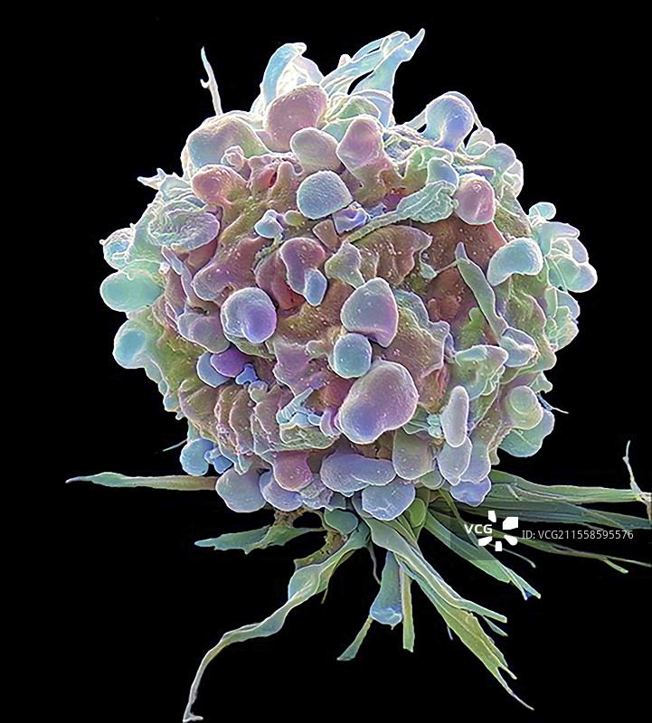 化疗诱导的细胞死亡，扫描电子显微镜图像图片素材