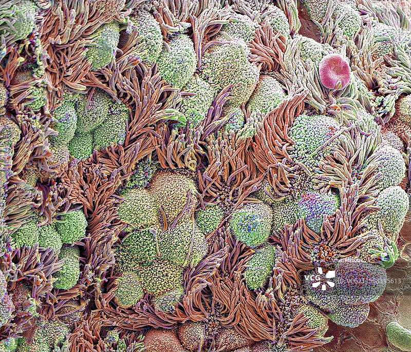 支气管，扫描电子显微镜图像图片素材