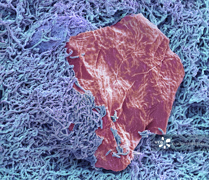 淋浴废水生物膜，扫描电子显微镜图片素材