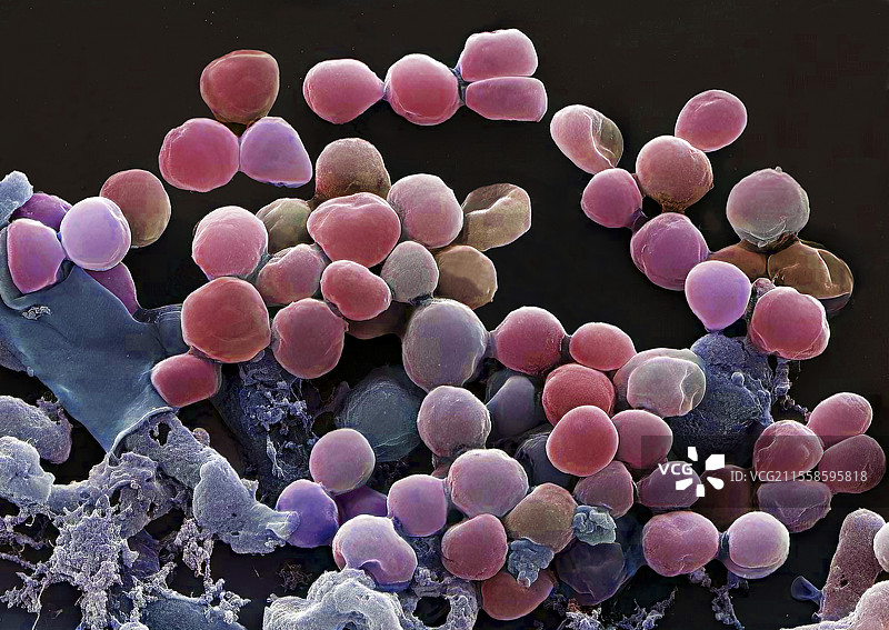 衣原体，扫描电子显微镜图像图片素材