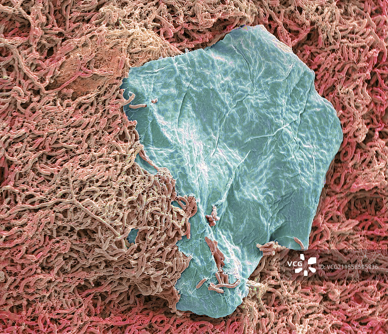 淋浴废水生物膜，扫描电子显微镜图片素材