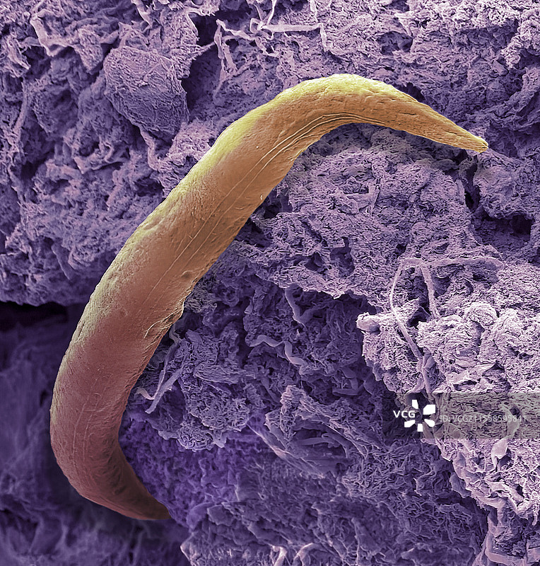 淋浴废水生物膜，扫描电子显微镜图片素材