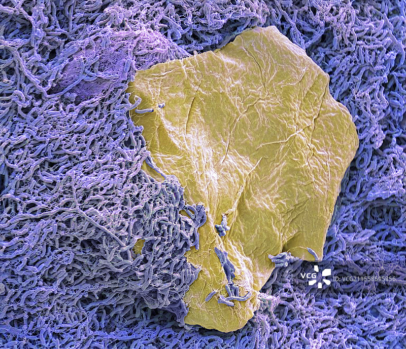 淋浴废水生物膜，扫描电子显微镜图片素材