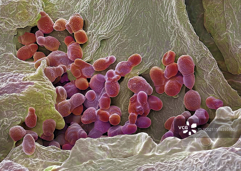 痤疮细菌，扫描电子显微镜图像图片素材