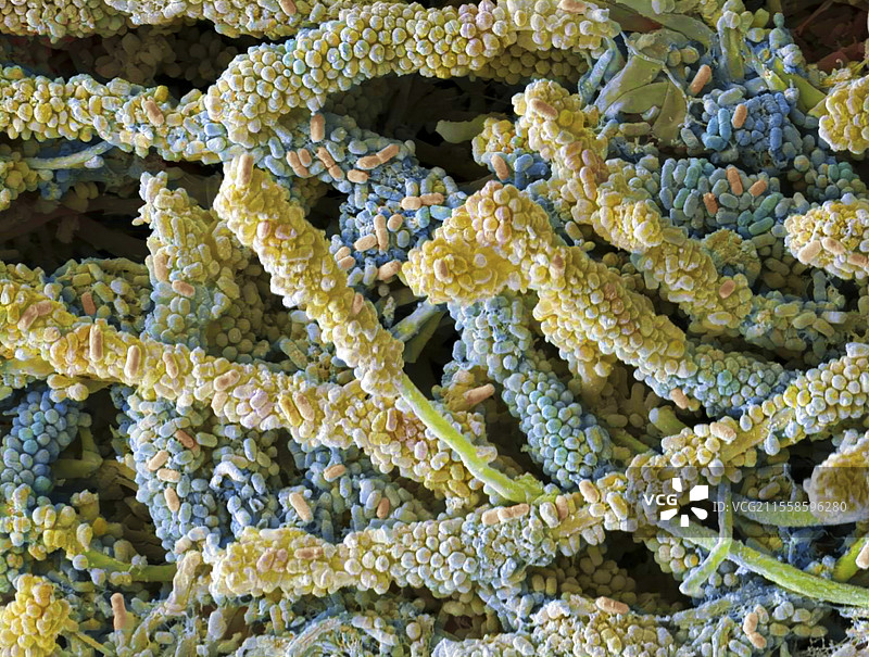 斑块形成细菌，扫描电子显微镜图像图片素材