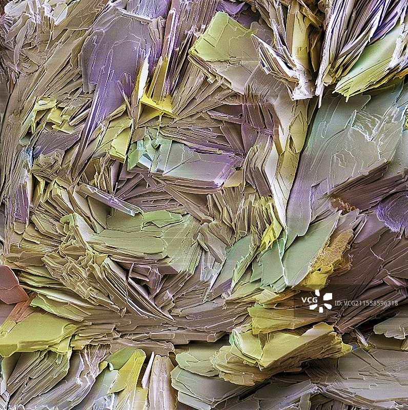 胆结石晶体，扫描电子显微镜图片素材