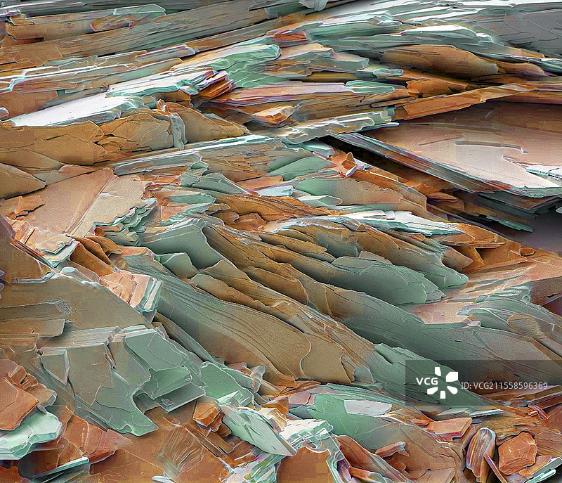 胆结石晶体，扫描电子显微镜图片素材