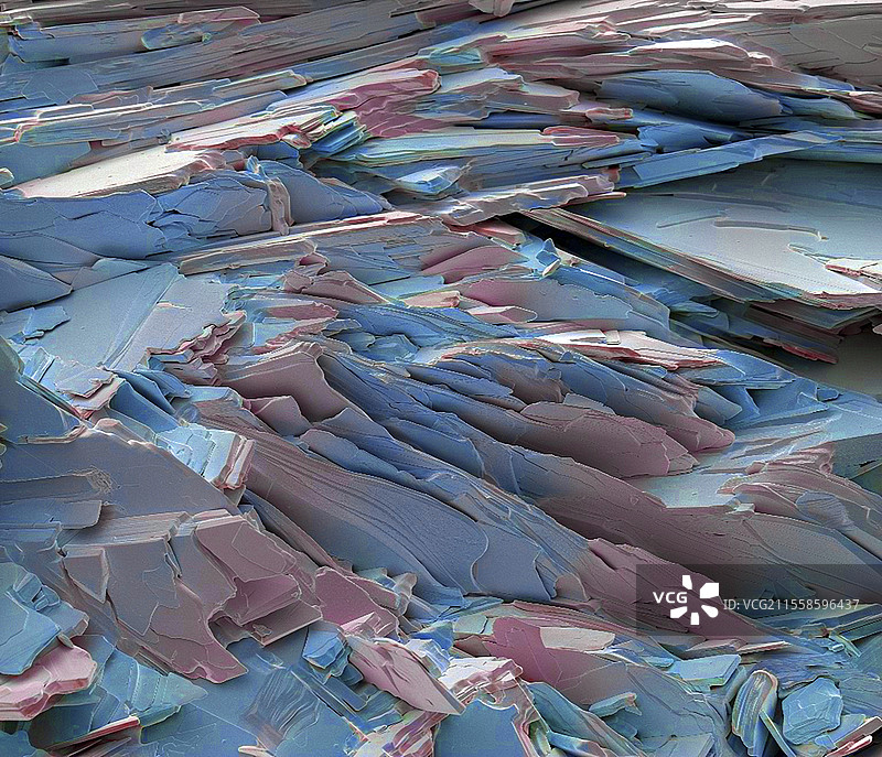 胆结石晶体，扫描电子显微镜图片素材