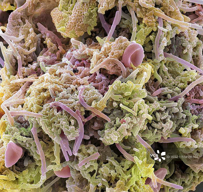 斑块形成细菌，扫描电子显微镜图像图片素材