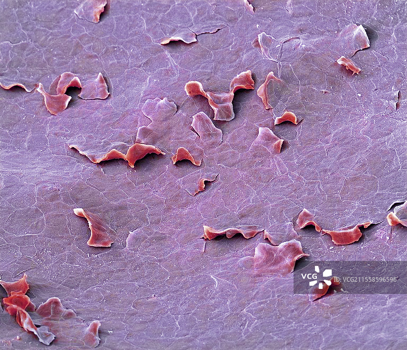 硬腭内衬，扫描电子显微镜图像图片素材