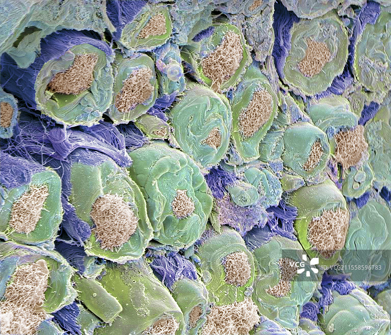 坐骨神经，扫描电子显微镜图像图片素材