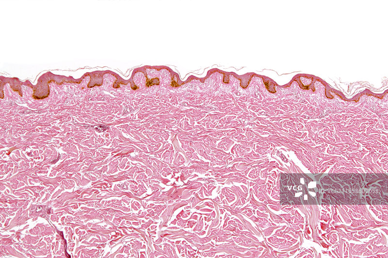 黑人的皮肤剖面图图片素材