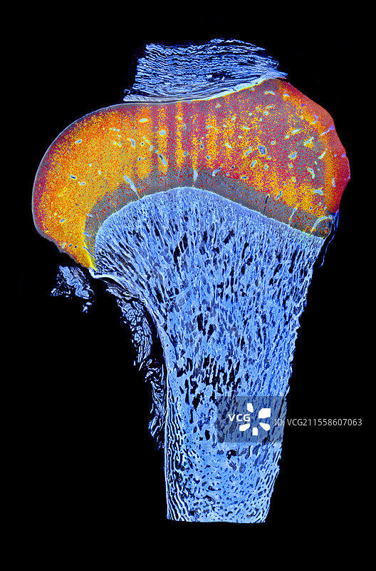 生长中的长骨截面图片素材