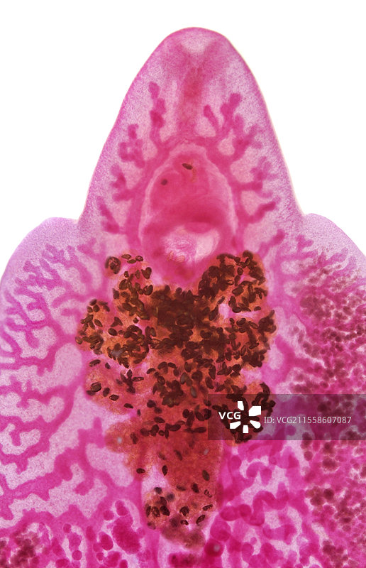 肝吸虫，肝吸虫（Fasciola hepatica）图片素材