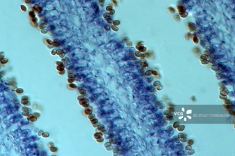 真菌果实体，光学显微镜图像图片素材