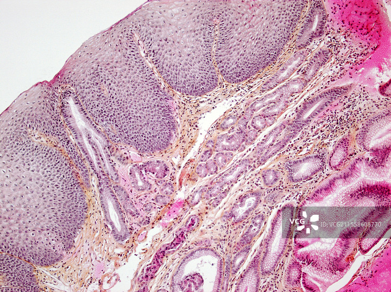 巴雷特食管，光学显微镜图像图片素材