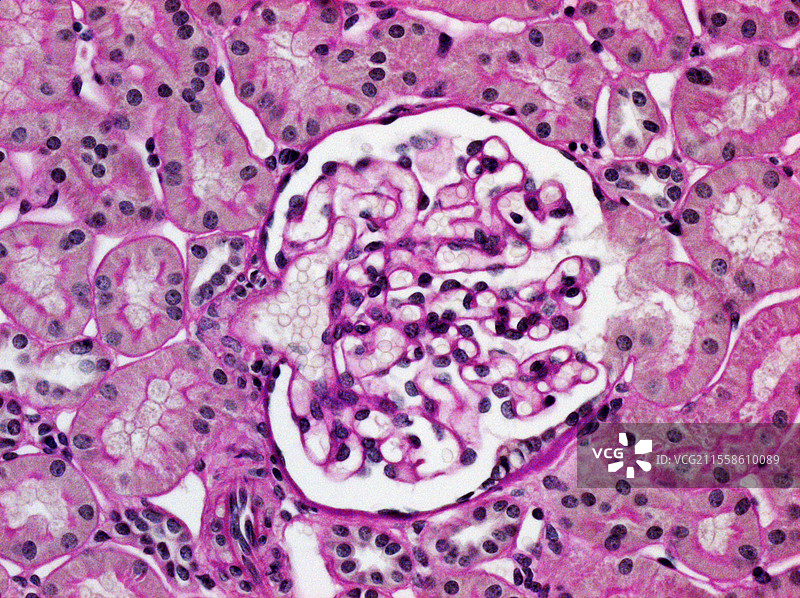 肾小球，光学显微镜图像图片素材
